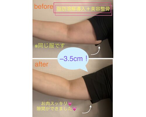 E378A394-4A8F-42D4-909E-0EE9BB9EAF92