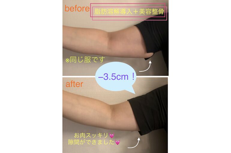 E378A394-4A8F-42D4-909E-0EE9BB9EAF92