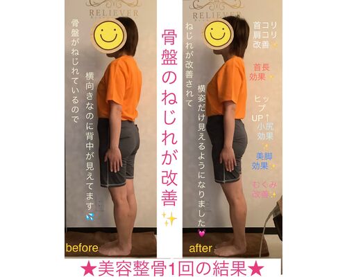 1EC33D00-FEDE-411E-815C-E9218B8AD68E