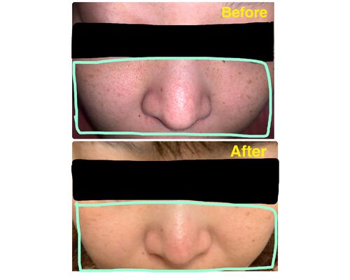1A2BFE79-BC13-4889-B16E-176A148268A7